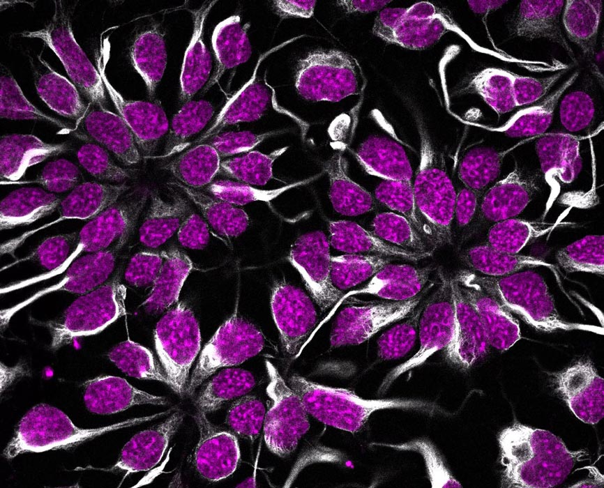 Anna Duarri - Neural flowers